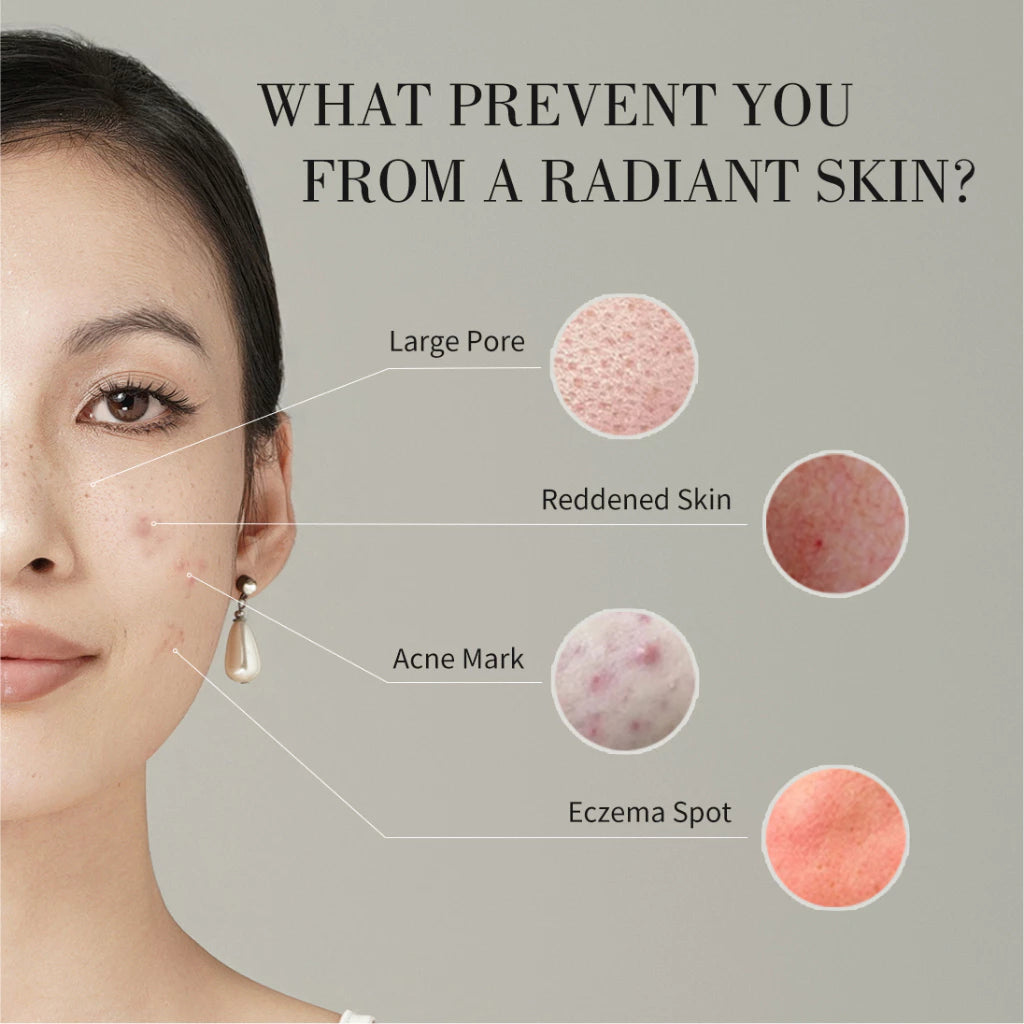 Jovs Blacken Pro Phototherapy Rejuvenation Device