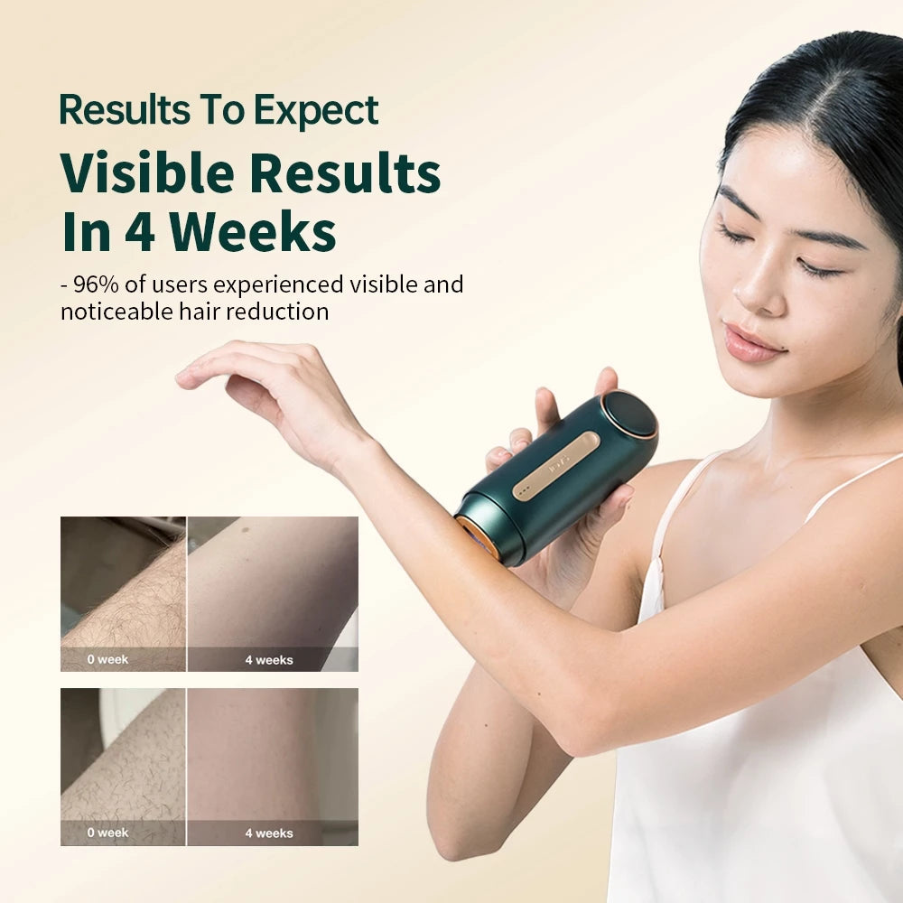 Jovs Mini IPL Hair Remover