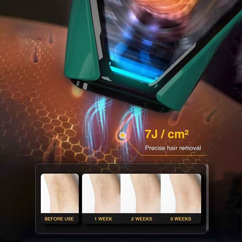 Jovs X IPL Hair Remover