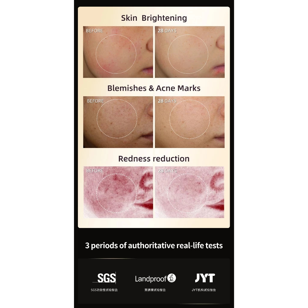 Jovs Blacken Pro Phototherapy Rejuvenation Device